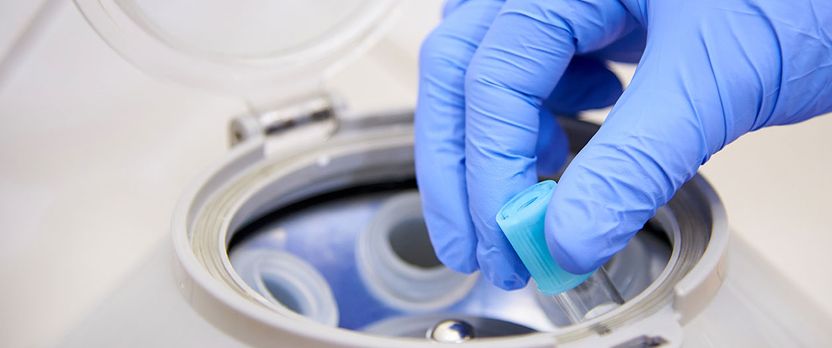 Curso Universitario de Especialización en Fundamentos y Técnicas Básicas en Análisis Clínicos