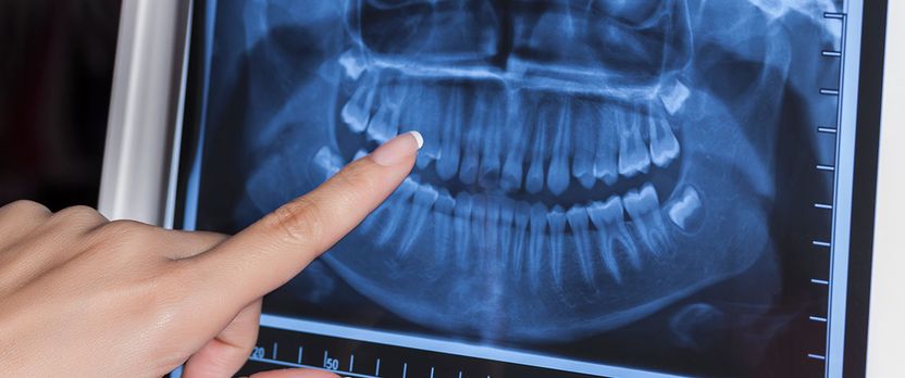 Curso Universitario de Especialización en Técnico en Radiología Dental
