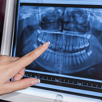 Curso Universitario de Especialización en Técnico en Radiología Dental