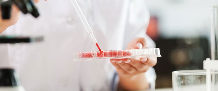 Curso Universitario de Especialización en Interpretación de Análisis de Sangre