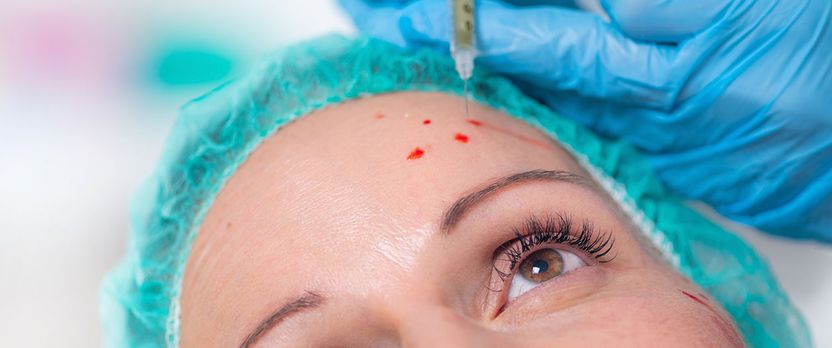 Curso Universitario de Especialización en Tratamiento con Plasma Rico en Plaquetas (PRP)