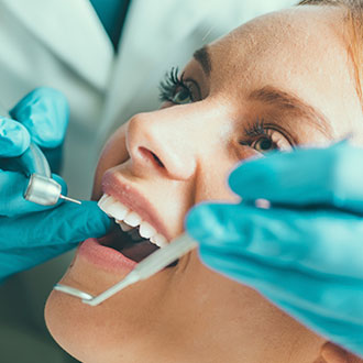 Curso Universitario de Especialización en Estética Dental