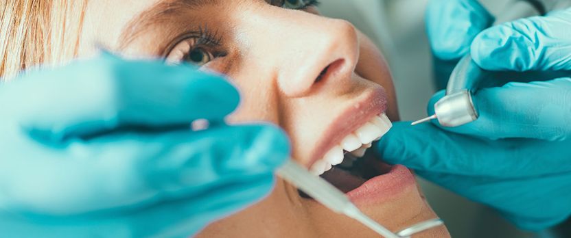 Curso Universitario de Especialización en Estética Dental
