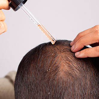Curso Universitario de Especialización en Manejo Integral de la Alopecia