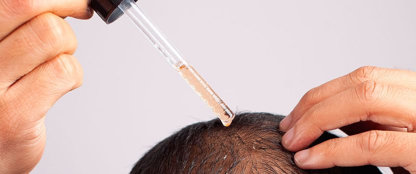 Curso Universitario de Especialización en Manejo Integral de la Alopecia