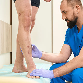 Curso Universitario de Especialización en Estrategias de Intervención en Fisioterapia Venosa y Linfática