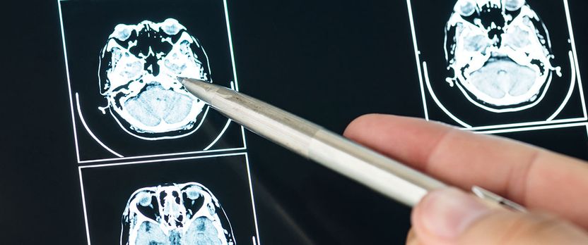 Curso Universitario de Especialización en Traumatismo Craneoencefálico