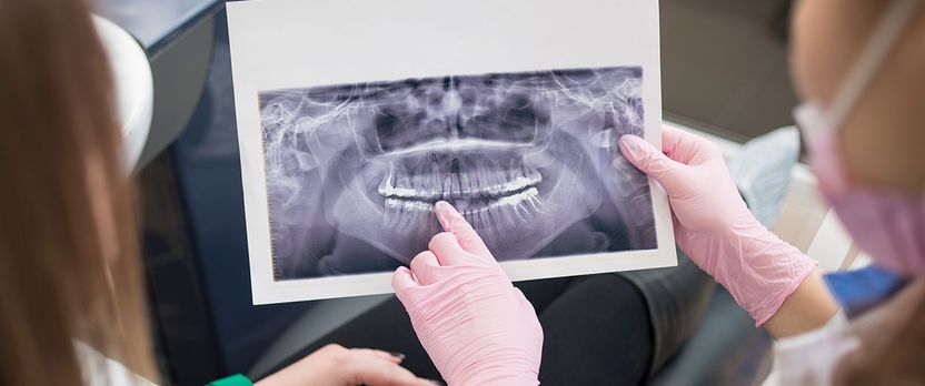 Curso de Desarrollo Profesional en Radiología Bucodental: Fundamentos, Técnicas y Protección