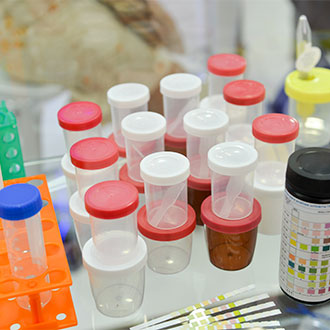 Curso en Técnicas preanalíticas y manejo de muestras biológicas en el laboratorio clínico