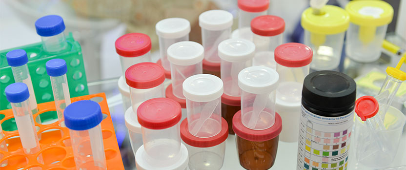 Curso en Técnicas preanalíticas y manejo de muestras biológicas en el laboratorio clínico