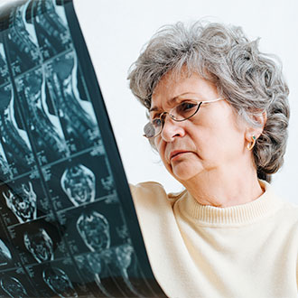 Curso en Envejecimiento y patologías neurodegenerativas