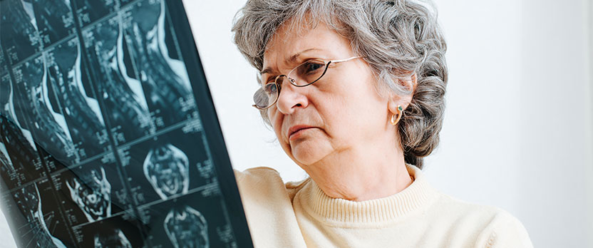 Curso en Envejecimiento y patologías neurodegenerativas