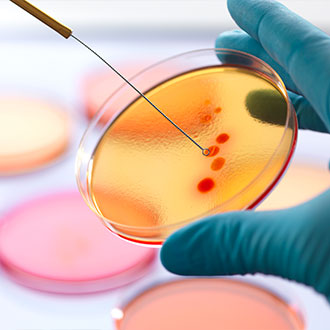 Curso en Microbiología clínica aplicada al diagnóstico y tratamiento de enfermedades infecciosas