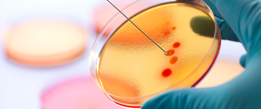 Curso en Microbiología clínica aplicada al diagnóstico y tratamiento de enfermedades infecciosas