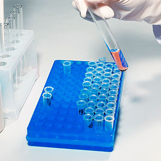 Curso Universitario de Especialización en Técnico en Análisis Clínico en Hematología