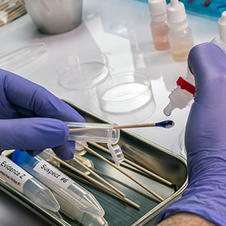Curso Universitario de Especialización en Técnico en Hematología y Hemoterapia