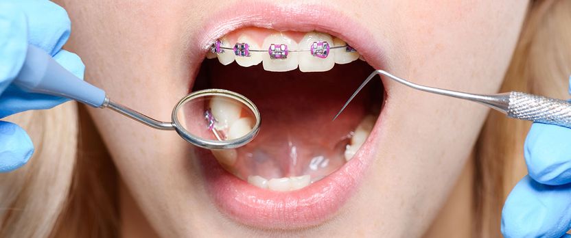Curso Universitario de Especialización en Periodoncia para Higienistas Dentales