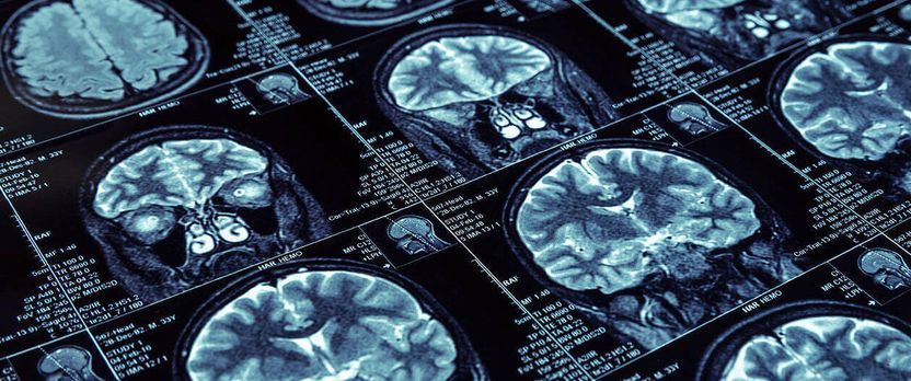 Curso Universitario de Especialización en Neurocirugía Básica