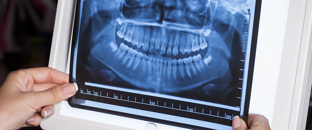 Imagen de Radiología dental y para que se utilizan
