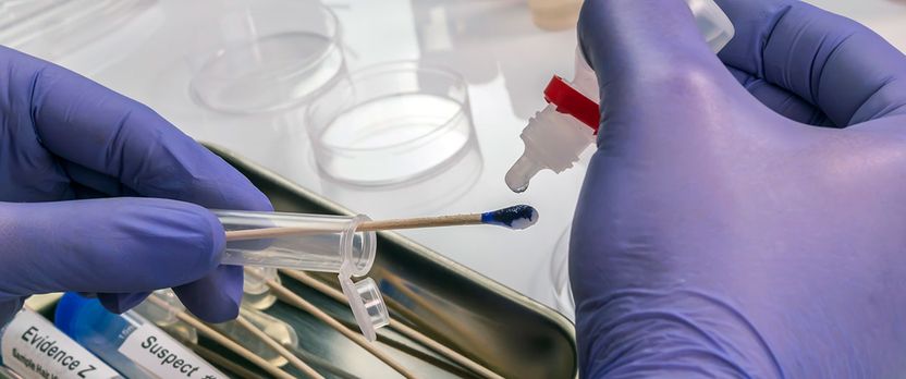 Curso Universitario de Especialización en Técnico en Hematología y Hemoterapia