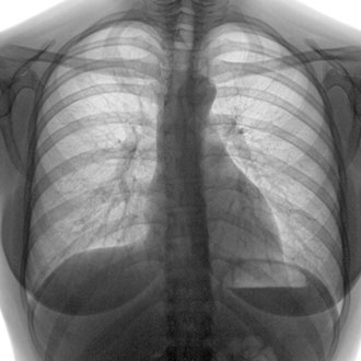Imagen de Curso de Desarrollo Profesional en Radiología Torácica y Patologías Pulmonares