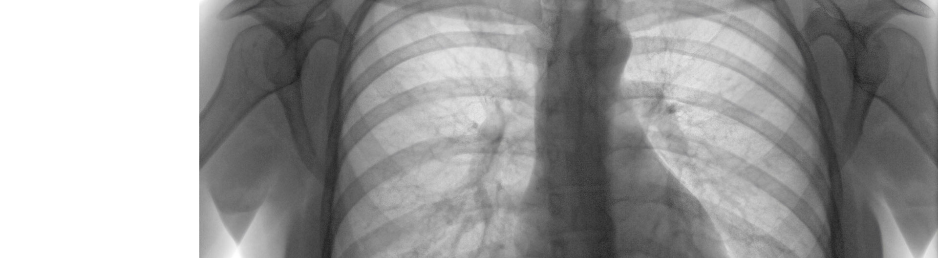 Curso de Desarrollo Profesional en Radiología Torácica y Patologías Pulmonares