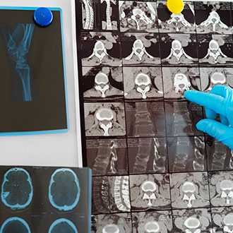 Imagen de Curso de Desarrollo Profesional en Resonancia Magnética: Técnicas, Diagnóstico y Patologías Frecuentes