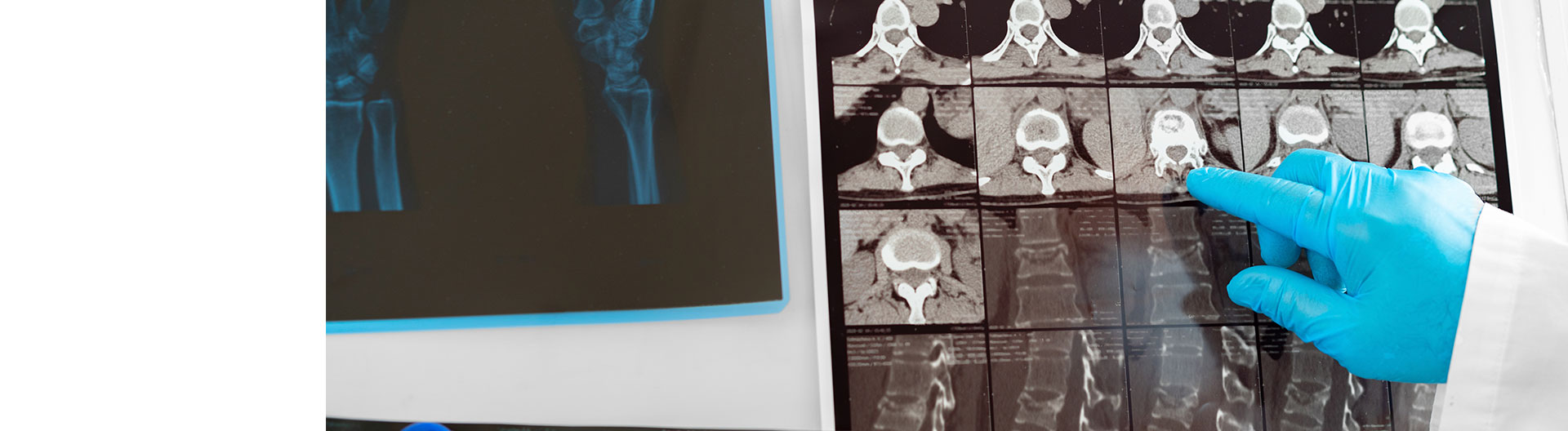 Curso de Desarrollo Profesional en Resonancia Magnética: Técnicas, Diagnóstico y Patologías Frecuentes